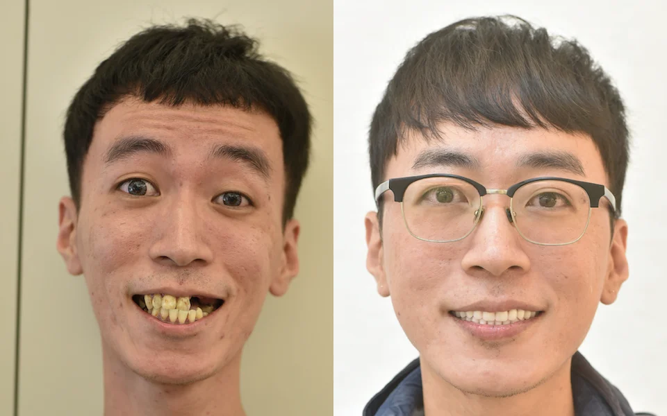 謝旻凱案例精選
