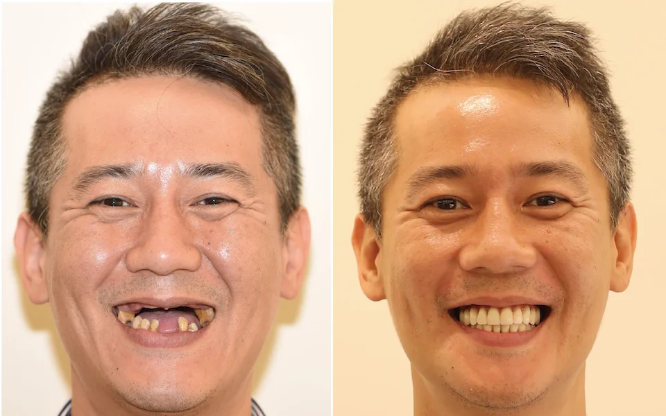 陳曉光案例精選
