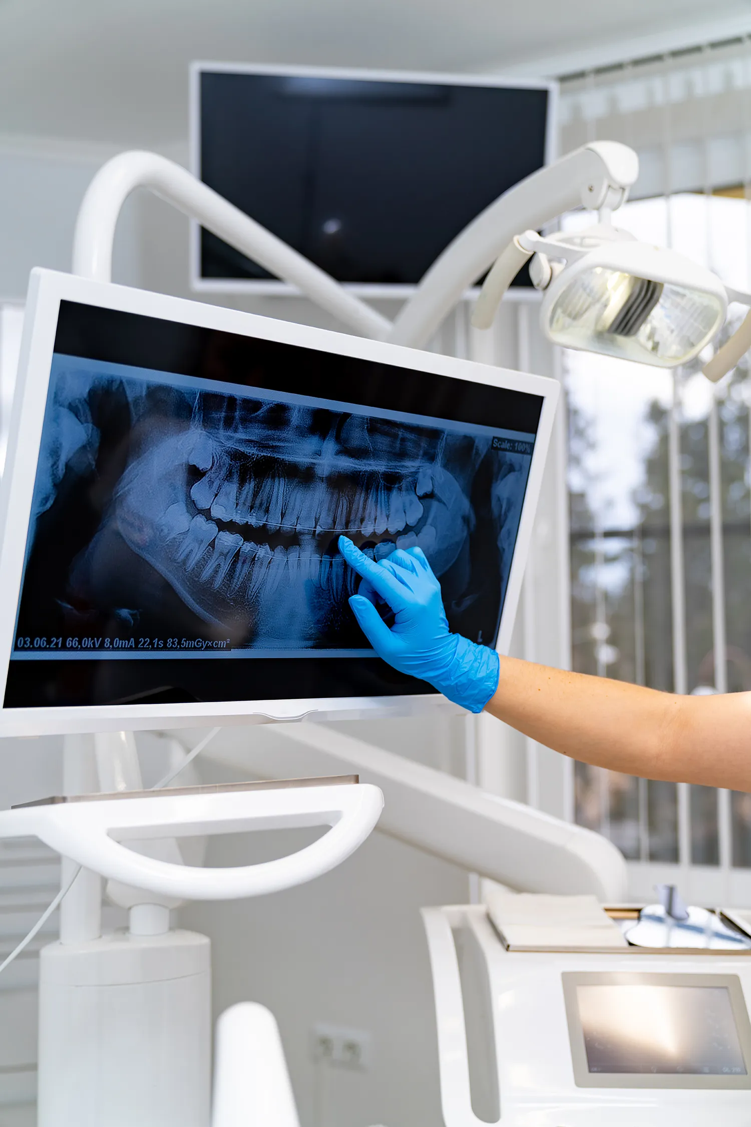 Teeth Professional Examining X Ray Dentistry Radiography Treatment