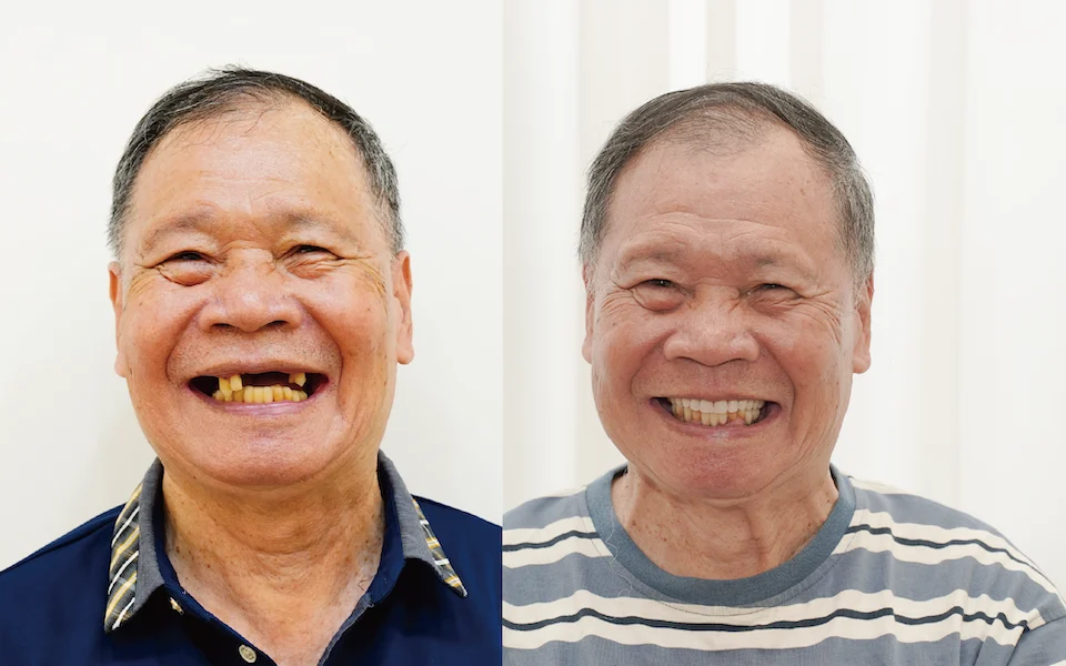 王年添案例精選