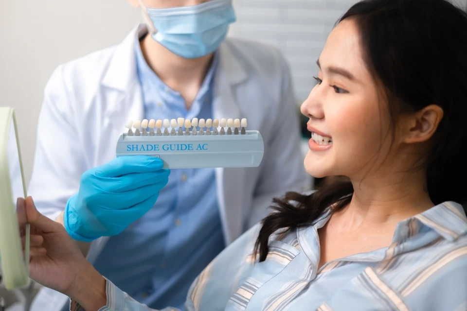 陶瓷貼片費用是多少？牙齒貼片價格影響因素與價格指南