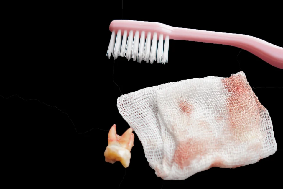 拔牙後多久可以刷牙?牙醫教你安全刷牙時機與4個術後清潔重點