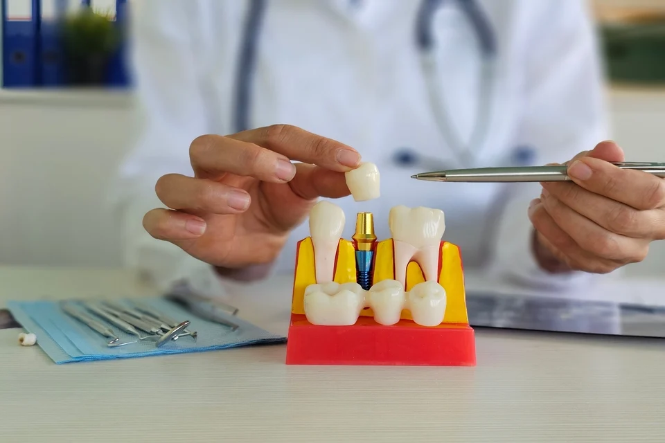 揭密韓國植體3大特色！帶你掌握韓國植牙品牌崛起關鍵