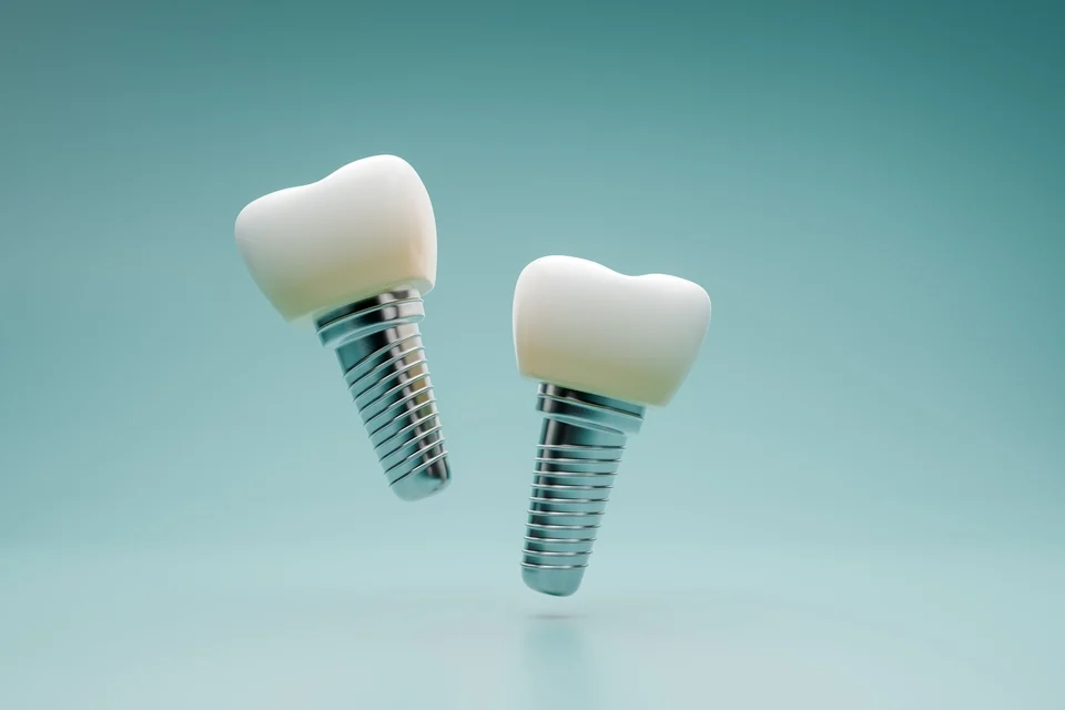 單顆假牙可以做嗎?3 分鐘搞懂單顆固定假牙優缺點