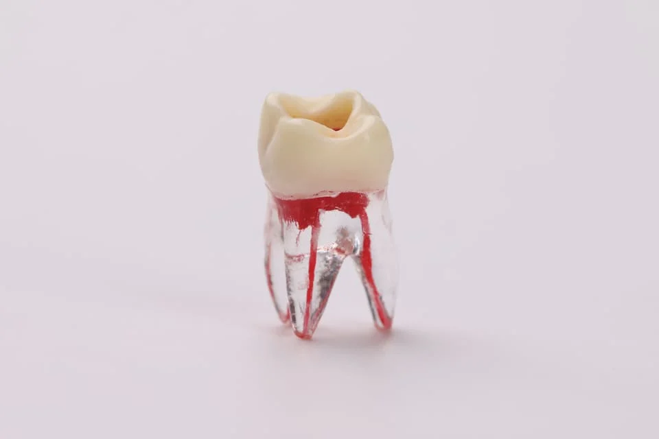 活髓治療後遺症可能發生嗎？失敗會怎樣？醫師揭密真相與補救SOP