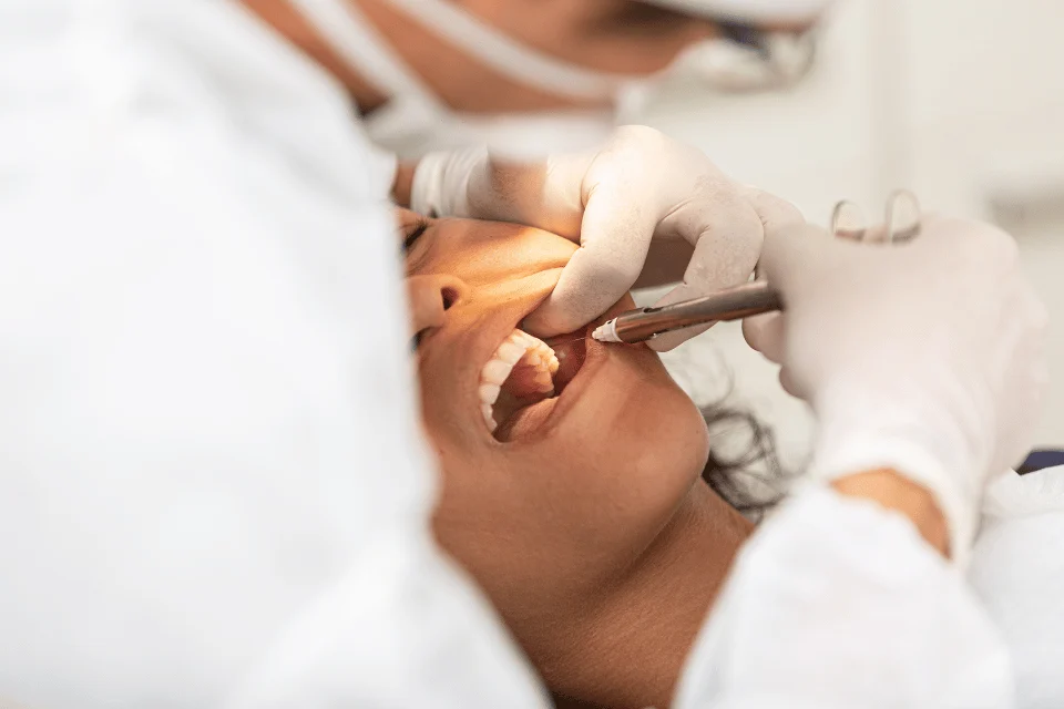 拔智齒膠原蛋白是什麼？需要放嗎？牙醫師教你5個判斷方法